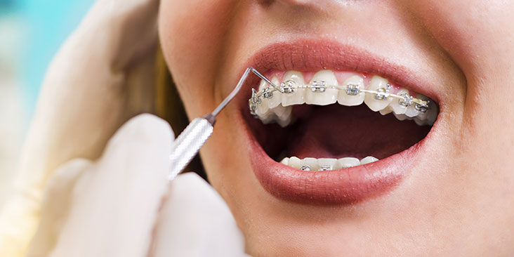 Dentist adjusting dental braces